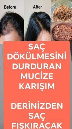 Sac Dokulmesini Durdurun Sac Dokulmesi Sac Dogal Saglik