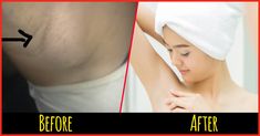 swollen lymph nodes under arm swollen lymph nodes under arm