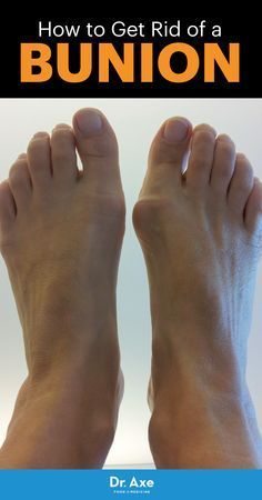 How To Get Rid Of Uric Acid Build Up Naturally How To Get Rid Of Uric Acid Build Up Naturally