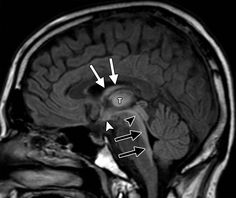 260 Neuroradiology + head n neck ideas | radiology, head and neck