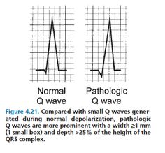 cardiac case study physical therapy Case description: two case studies illustrated possible consequences of copd copd: chronic obstructive pulmonary disease pt: physical therapist gold: cardiovascular disease is probably the most frequent comorbidity in copd. cardiac case study physical therapy Case description: two case studies illustrated possible consequences of copd copd: chronic obstructive pulmonary disease pt: physical therapist gold: cardiovascular disease is probably the most frequent comorbidity in copd.