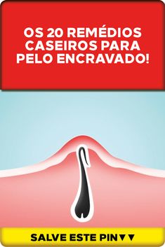 Infectados de pêlos tratamento caseiro encravados