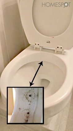 What Are the Causes of Mold in a Toilet Bowl? | Toilet bowl, Toilet ... What Are the Causes of Mold in a Toilet Bowl? | Toilet bowl, Toilet ...