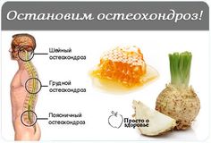 Как дома вылечить шейный остеохондроз дома самому