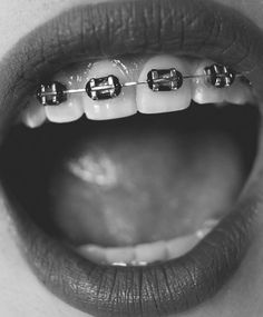 Girls with braces having oral sex idea simply Would like Girls with braces having oral sex