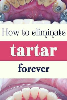 Best weight loss pills from mexico picture 8