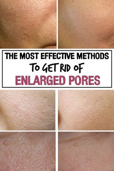 how to close pores naturally and correctly reduce pore size clear how to reduce the size of pores