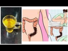 عملية البواسير المشاكل التي قد تحدث بعدها ويب طب