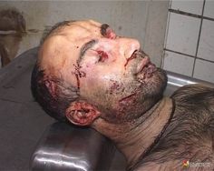 9 best autopsies embalming images crime scenes death forensics