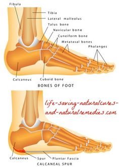 Natural Remedy For Bone Spurs In Neck Natural Remedy For Bone Spurs In Neck