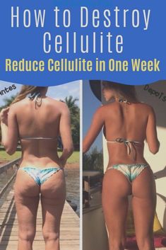 Diät, um Cellulite-Oberschenkel zu verlieren Diät, um Cellulite-Oberschenkel zu verlieren