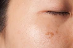 cosmetica decorativa wikipedia aluris anti-imbatranire