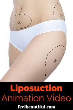 Healthy weight loss for teenage girl image 4
