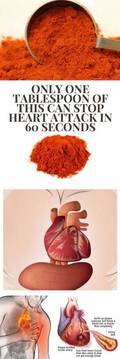 4 warning signs you may have clogged arteries and how to unclog them