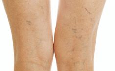 13 Ideas De Belleza Salud Y Belleza Recetas De Belleza Tratamientos De Belleza