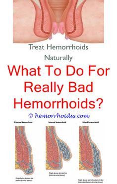 Anal sex suppositories hemmorrhoids Two bisexual couples