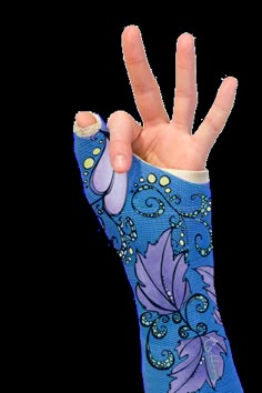 14 Ideas De Ferula Decorativa Yeso En El Brazo Fractura De Hueso Thing 1