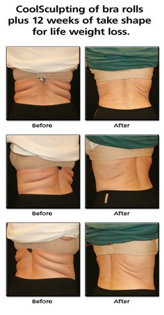 Best walking weight loss app picture 5