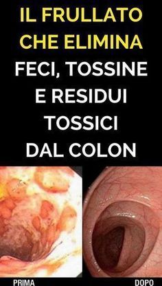 come ha fatto il monique a perdere peso