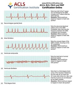 kinda good information ill never forget these now nursing heart rhythm chart