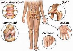 Voi vindeca durerile articulare boala artrita de sold
