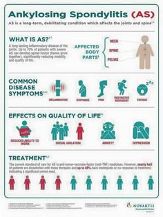 Ankylosing spondylitis autoimmune chronic pain Ankylosing spondylitis autoimmune chronic pain
