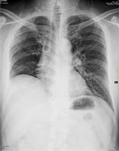 passmedicine mrcp part 2 pdf
