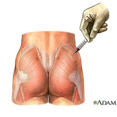 Im injection butt ass nurse Sociopath facial expression photography
