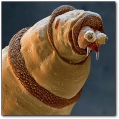 86 best things under microscope images electron microscope