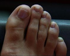 foot fetish psycho Porno xxx noir