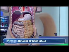 dieta per reflusso laringofaringeo dieta per reflusso laringofaringeo