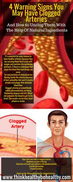 4 warning signs you may have clogged arteries and how to unclog them