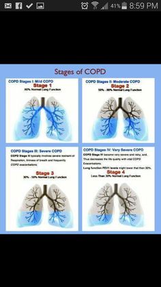 copd life expectancy stages and prognosis here are your when to take vitamins chart