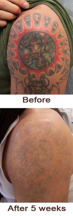this client wasn u0027t happy with their half sleeve after just a few this client wasn u0027t happy with their half sleeve after just a few