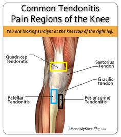 Natural Cures For Bursitis And Tendonitis Natural Cures For Bursitis And Tendonitis