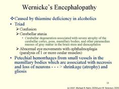 shermeen abbas shabbas019 on pinterest wernicke encephalopathy