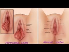 How To Tighten Your Vagina Naturally One Day And Make Your Man Happy Youtube Wellness How To Tighten Your Vagina Naturally One Day And Make Your Man Happy Youtube Wellness
