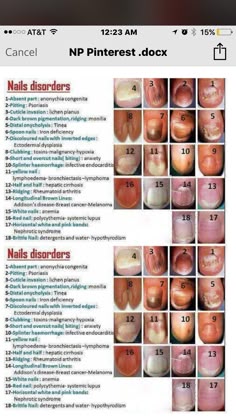 Nails Disorder Chart Nail Diseases Health Disorders Medical Pediatric Nurse Pracioner Health Chart Np School