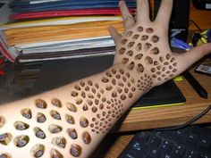 Trypophobia Trypophobia: Introduction,