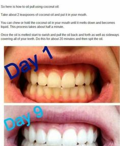 oil pulling 101 10 tips for making it work oil pulling coconut oil pulling works
