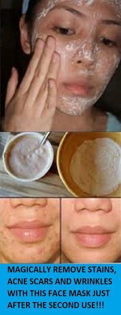 Fucking dripping facial mask removes discoloration jamaican butt hot