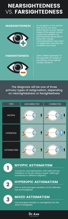 42 best keratoconus images