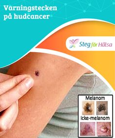 aggressiv bröstcancer symtom aggressiv bröstcancer symtom