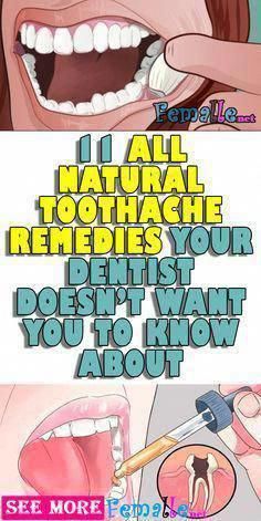 Pin On Does Insurance Cover Oral Care