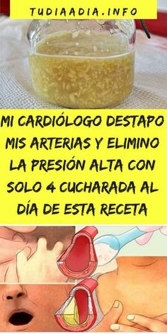 Mi presión arterial es alta sin ninguna razón