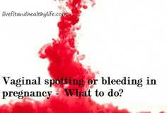 Are going Vaginal spotting during pregnancy understand Vaginal spotting during pregnancy