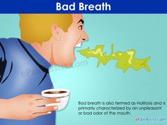 Bad Breath Treatment >> 25 Best Remedy For Halitosis Images In 2016 Bad Breath Remedy Bad Breath Treatment >> 25 Best Remedy For Halitosis Images In 2016 Bad Breath Remedy