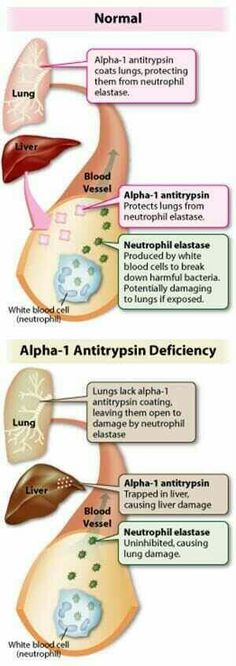 Natural Remedies And Methods For Copd Natural Remedies And Methods For Copd