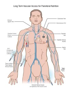 170 best iv therapy images nurses medicine nursing iv nurse
