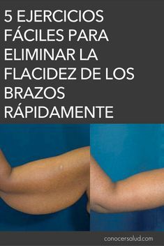 Como combatir la flacidez de los brazos